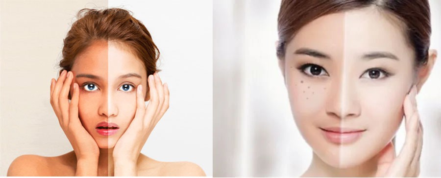 arbutin powder benefits for skin